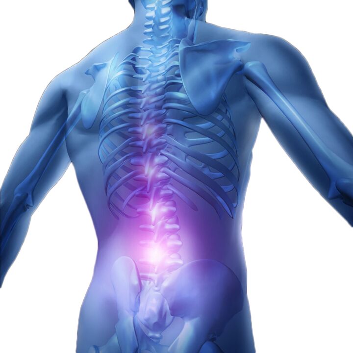 Muscle spasms and tightness can cause severe pain